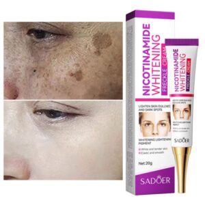 Nicotinamide Whitening Freckles Cream Face Skin Care