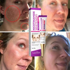 Nicotinamide Whitening Freckles Cream Face Skin Care