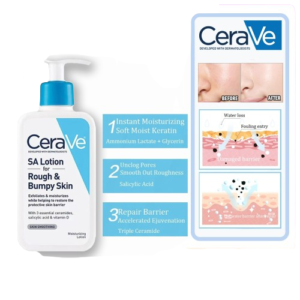 Cerave Sa Lotion For Rough & Bumpy Skin Vitamin D, Hyaluronic Acid, Lactic Acid & Salicylic Acid Lotion (237ml)