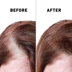 Anti Hair Loss Serum Ginger And Tocopherol Hair Growth Essence Oil Hair Care Serum