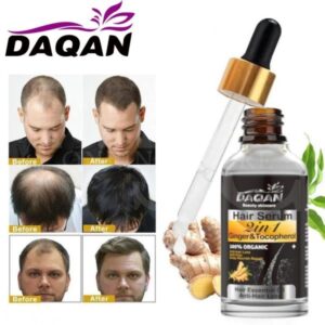 Anti Hair Loss Serum Ginger And Tocopherol Hair Growth Essence Oil Hair Care Serum