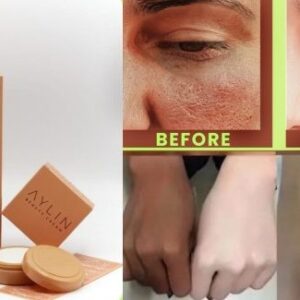 Aylin Beauty Cream For Face Acne Pimples, & Blackheads