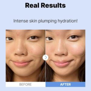 Cosrx Pure Sodium Hyaluronic Acid 3% Serum, Hydration & Moisture Boosting Facial Serum For Fine Lines & Wrinkles, Plump & Repair Dry Skin 20ml