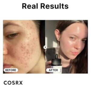 Cosrx Pure Sodium Hyaluronic Acid 3% Serum, Hydration & Moisture Boosting Facial Serum For Fine Lines & Wrinkles, Plump & Repair Dry Skin 20ml