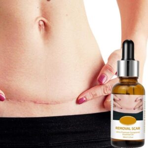 Acne Scar Removal Rejuvenation Serum Scar, C Section & Stretch Mark Removal Oil For Women