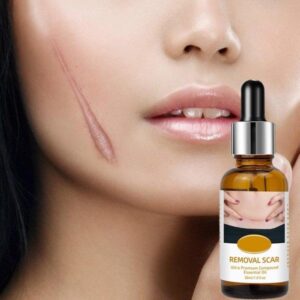Acne Scar Removal Rejuvenation Serum Scar, C Section & Stretch Mark Removal Oil For Women