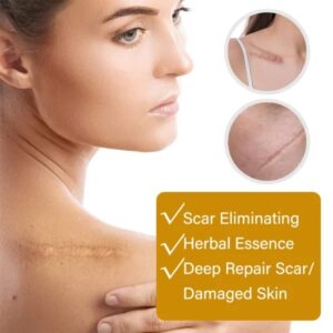 Acne Scar Removal Rejuvenation Serum Scar, C Section & Stretch Mark Removal Oil For Women