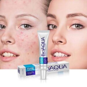 Bioaqua Anti Acne Cream Acne Scar Removal Cream 30g
