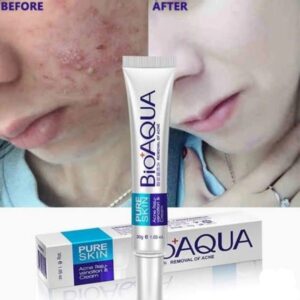 Bioaqua Anti Acne Cream Acne Scar Removal Cream 30g