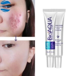 Bioaqua Anti Acne Cream Acne Scar Removal Cream 30g