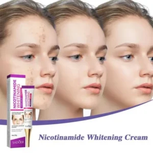 Nicotinamide Whitening Freckles Cream Face Skin Care